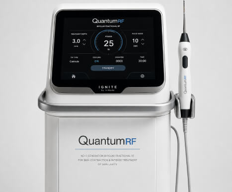 tecnologia quantum rf